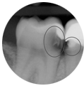 medailon_endodonticke-vysetreni