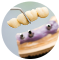 medailon_implantaty